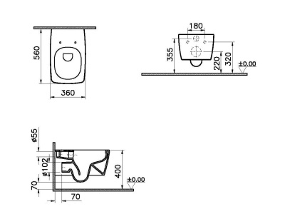 Комплект унитаза с инсталляцией Vitra Metropole 9820B003-7201 с сиденьем Микролифт и клавишей смыва Хром 